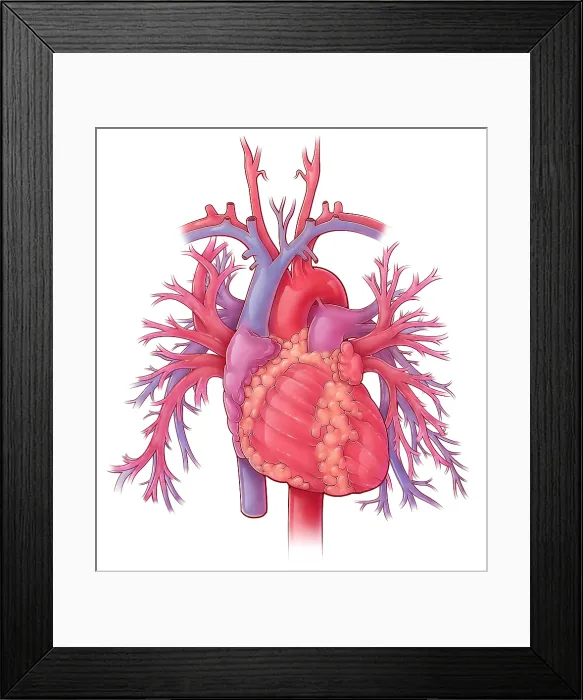 Framed Print : Heart and Pulmonary Vessels, Illustration Framed Print : Heart and Pulmonary Vessels, Illustration