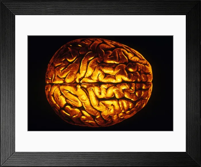 Framed Print : Human Brain Framed Print : Human Brain