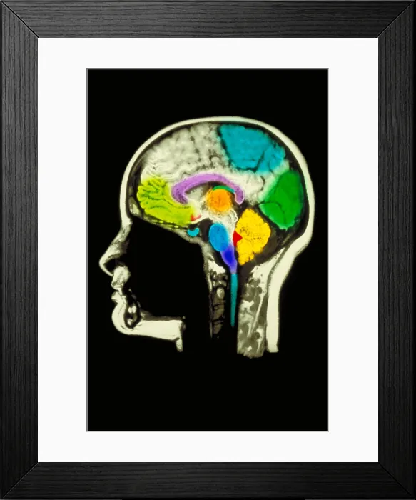 Framed Print : MRI head scan Framed Print : MRI head scan