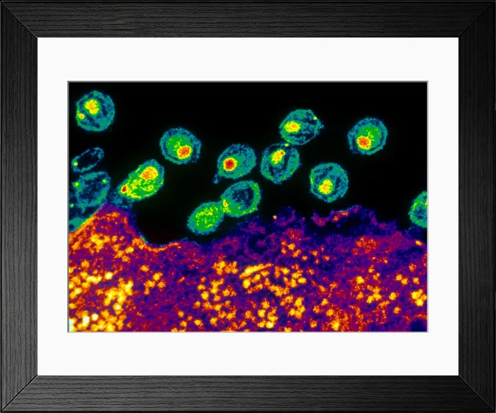 Framed Print : AIDS Virus (TEM) Framed Print : AIDS Virus (TEM)