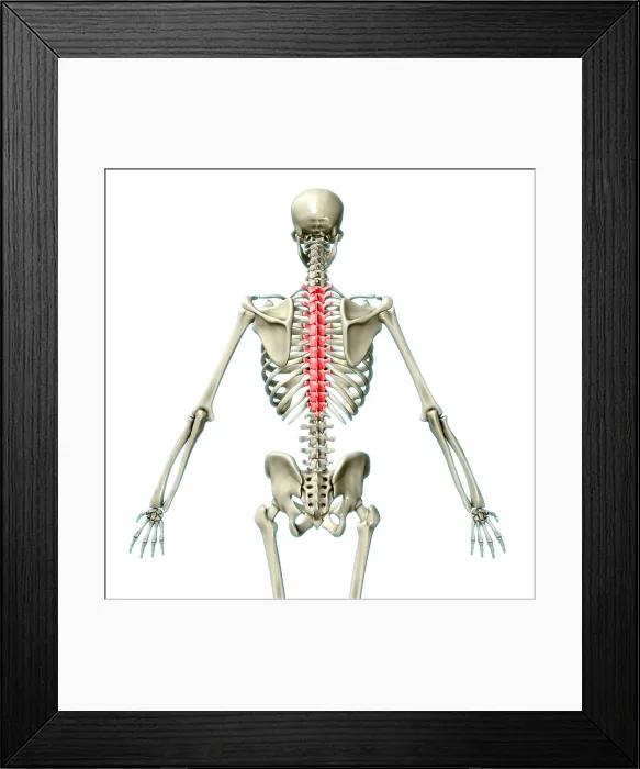 Framed Print : Thoracic Vertebrae, Illustration