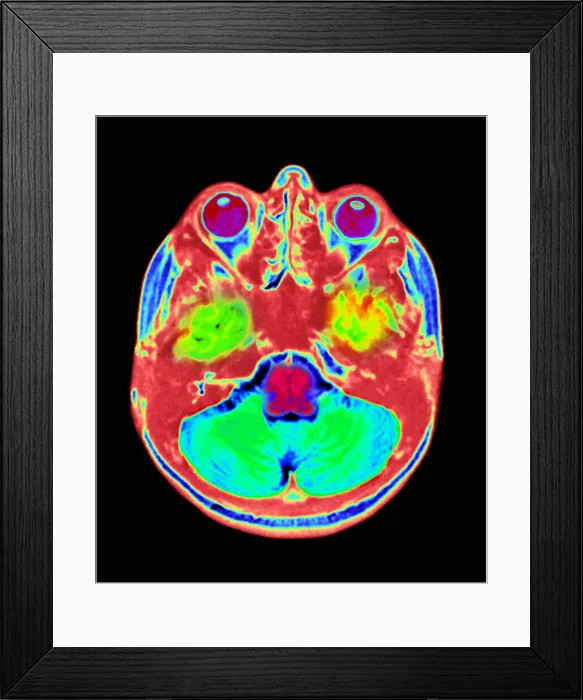 Framed Print : Normal MRI Framed Print : Normal MRI