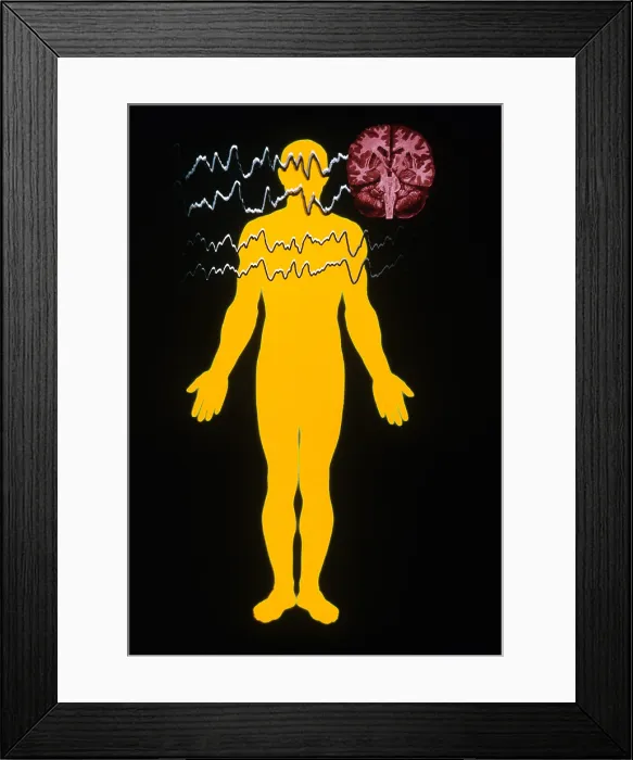 Framed Print : EEG of Tonic-clonic Seizure Framed Print : EEG of Tonic-clonic Seizure
