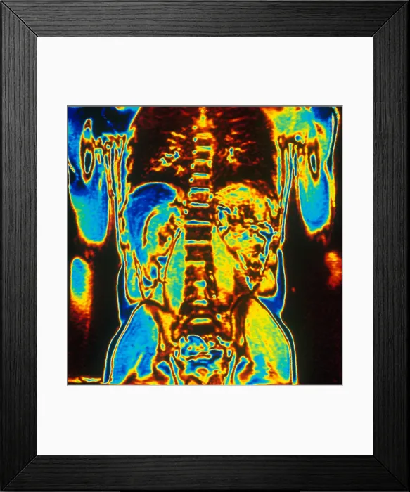 Framed Print : MRI of Human Torso Framed Print : MRI of Human Torso