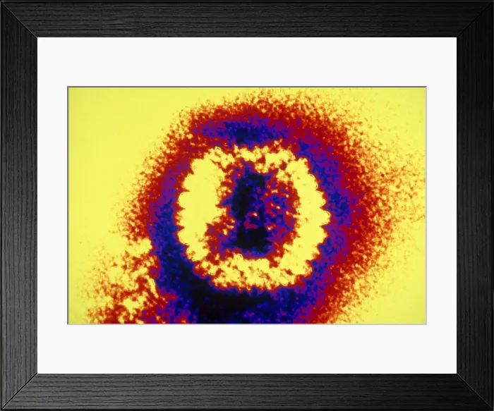 Framed Print : Herpes Simplex Virus (TEM)