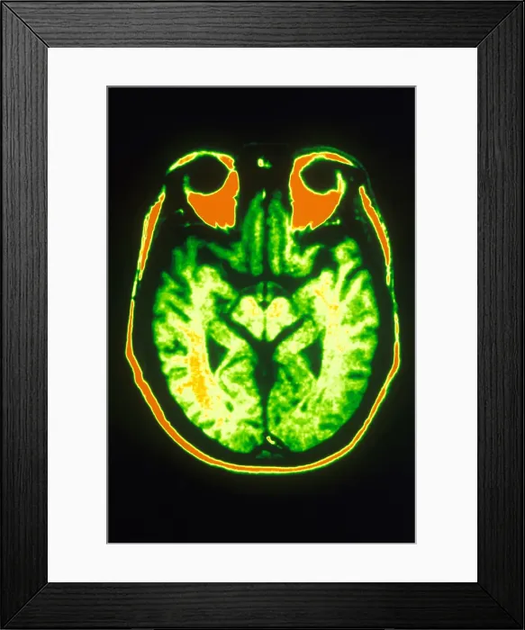 Framed Print : MRI of Brain Framed Print : MRI of Brain