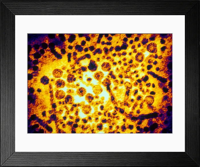 Framed Print : Hepatitis B Virus (TEM) Framed Print : Hepatitis B Virus (TEM)