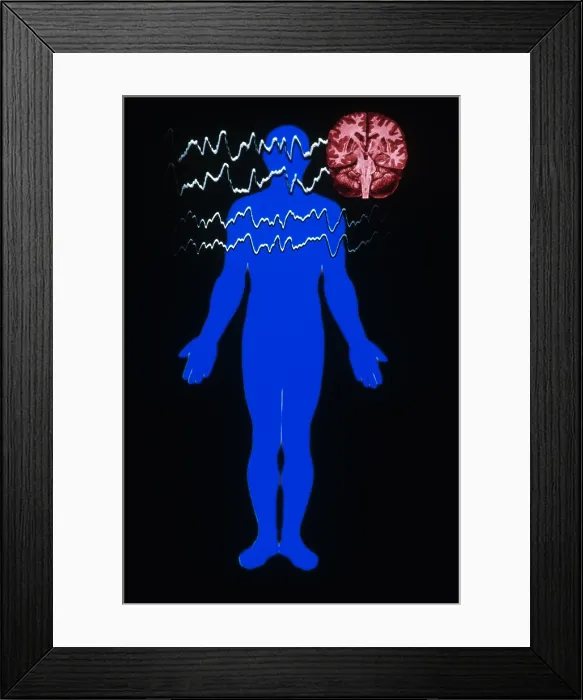 Framed Print : EEG of Tonic-clonic Seizure Framed Print : EEG of Tonic-clonic Seizure