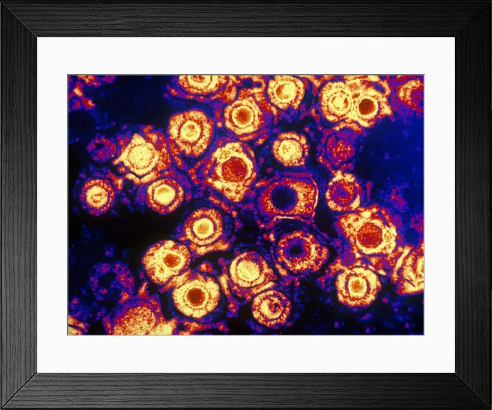 Framed Print : Herpes Simplex Virus (TEM)