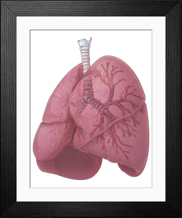 Framed Print : Lungs and Bronchi