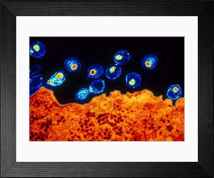 Framed Print : AIDS Virus (TEM)