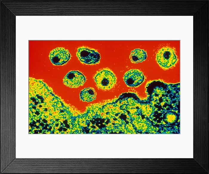 Framed Print : AIDS Virus (TEM) Framed Print : AIDS Virus (TEM)