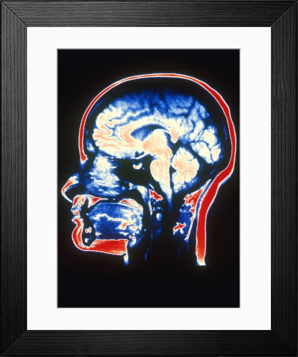 Framed Print : MRI of Head Framed Print : MRI of Head