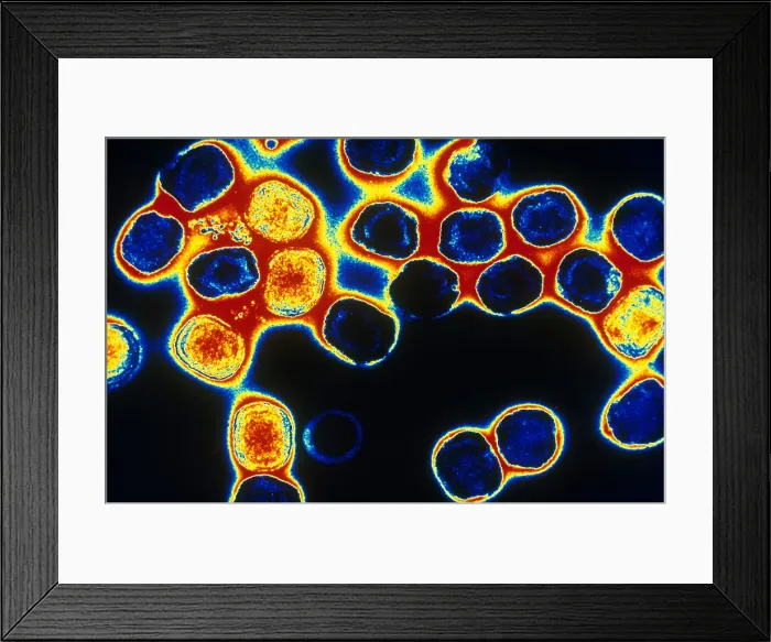 Framed Print : TEM of Vaccinia Virus Framed Print : TEM of Vaccinia Virus
