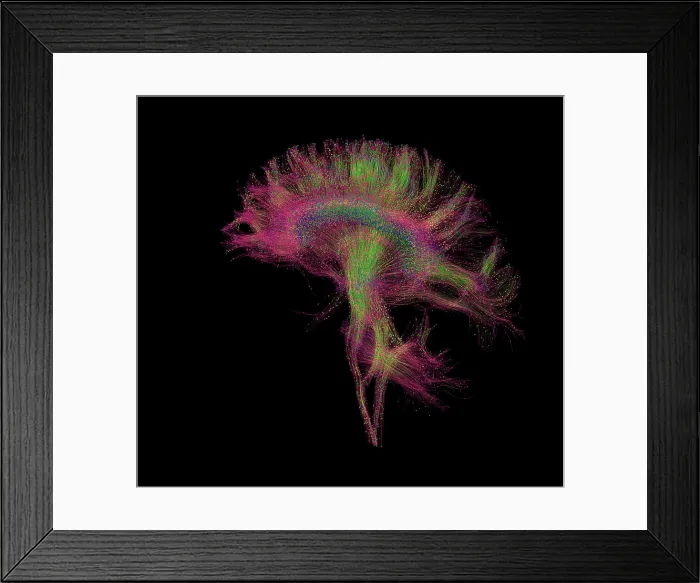 Framed Print : Brain, Fiber Tractography Image Framed Print : Brain, Fiber Tractography Image