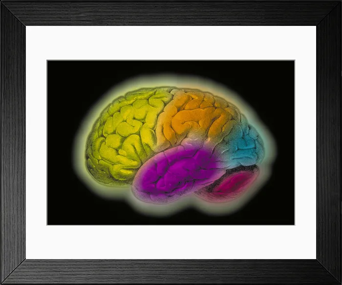 Framed Print : Human brain Framed Print : Human brain
