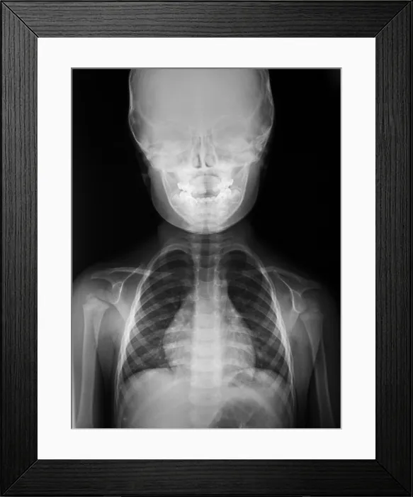 Framed Print : Head and Shoulders of Healthy 3 Year Old Boy Framed Print : Head and Shoulders of Healthy 3 Year Old Boy