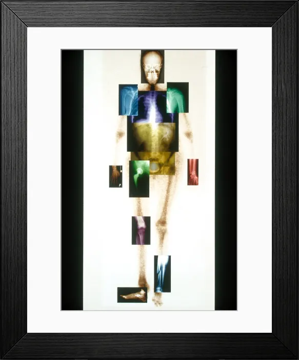 Framed Print : Medical Imaging Montage