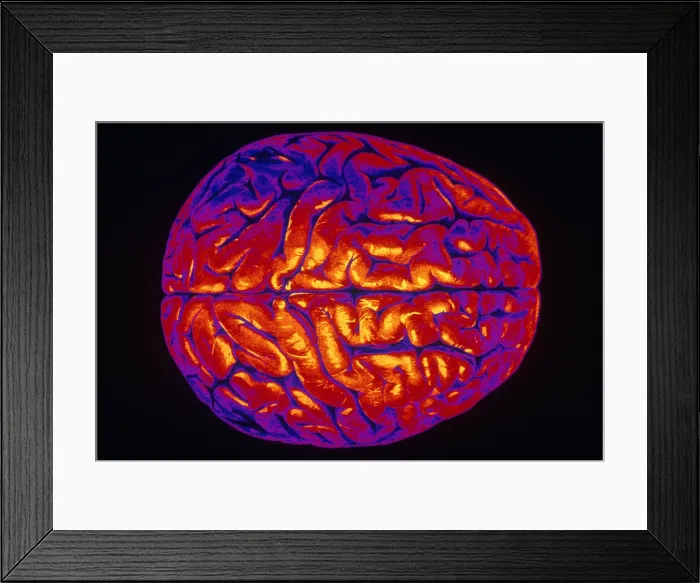 Framed Print : Human Brain Framed Print : Human Brain