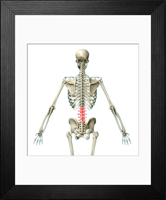 Framed Print : Lumbar Vertebrae, Illustration Framed Print : Lumbar Vertebrae, Illustration
