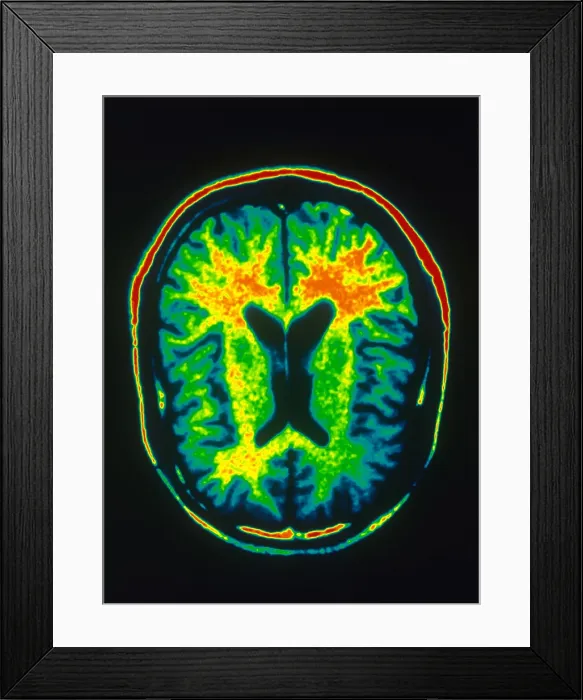 Framed Print : MRI of Brain Framed Print : MRI of Brain