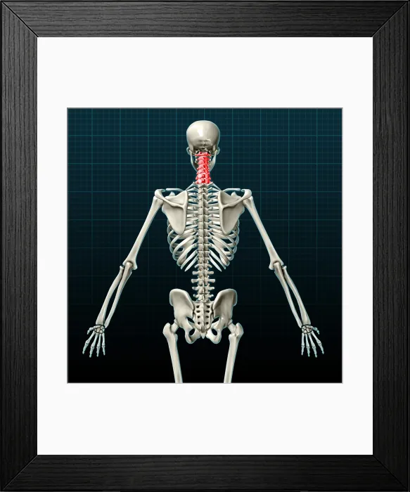 Framed Print : Cervical Vertebrae, Illustration