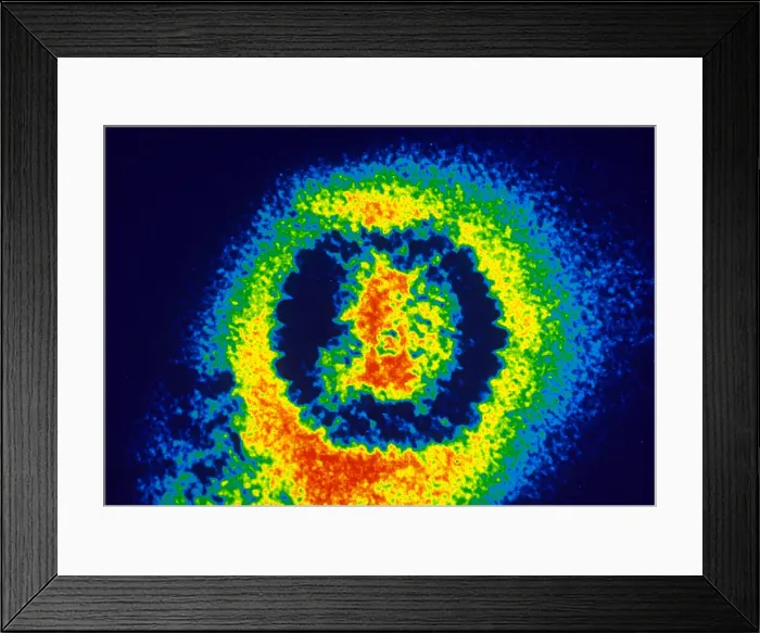 Framed Print : Herpes Simplex Virus (TEM)