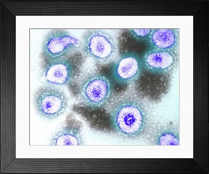 Framed Print : TEM of Coronavirus OC43
