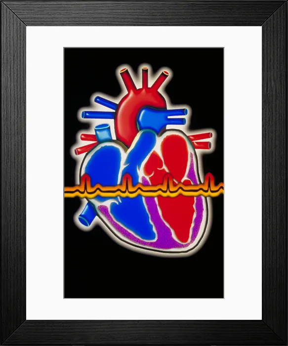 Framed Print : Computer illustration of the human heart