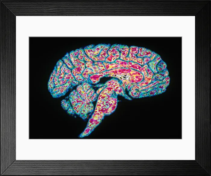 Framed Print : Sagittal Section of Brain Framed Print : Sagittal Section of Brain