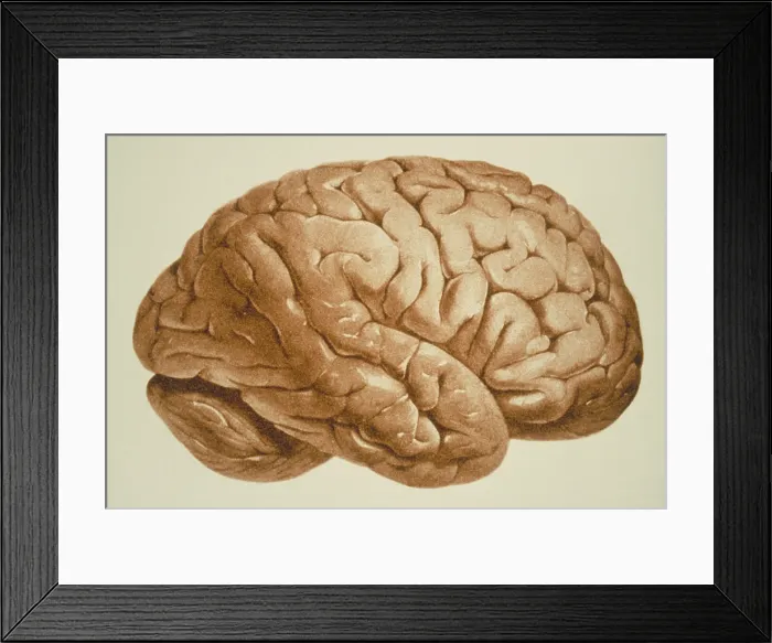 Framed Print : Human brain Framed Print : Human brain