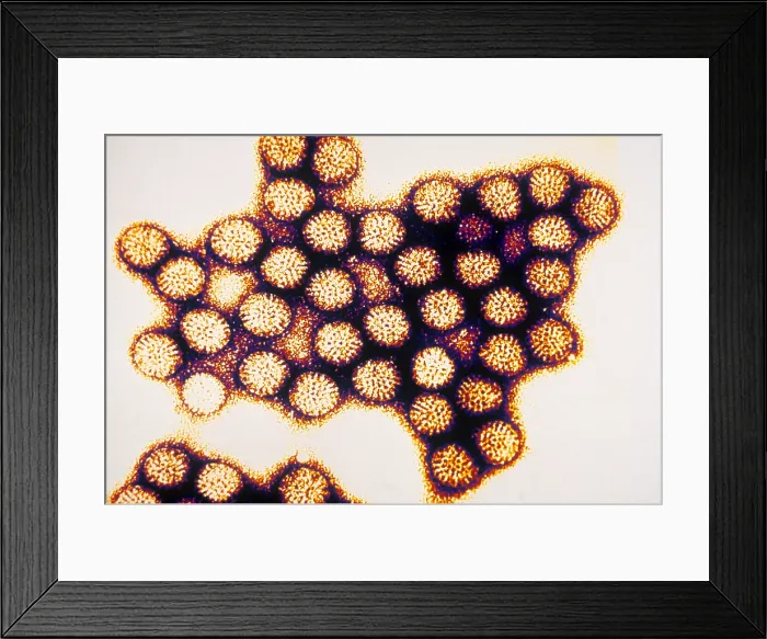 Framed Print : TEM of Rotavirus