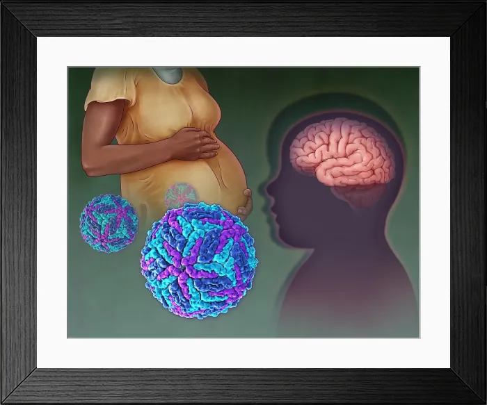 Framed Print : Zika Virus, illustration Framed Print : Zika Virus, illustration