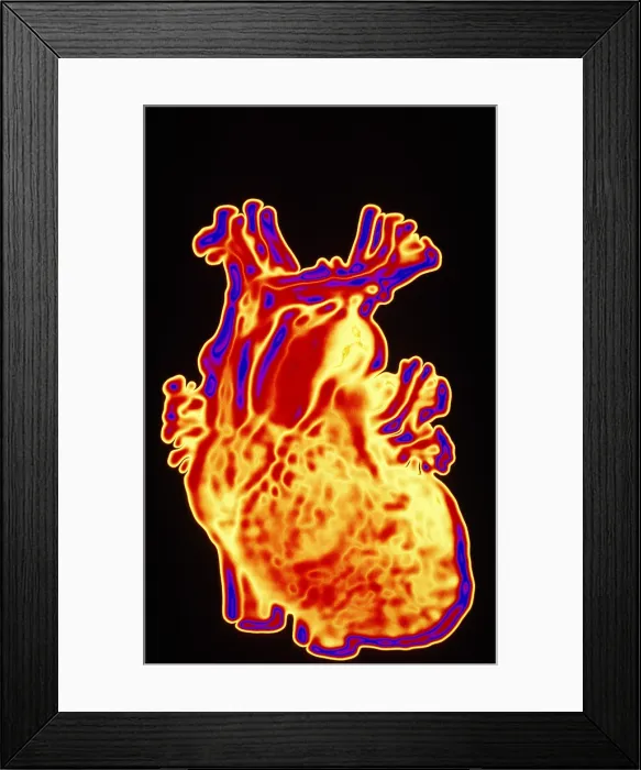 Framed Print : Computer enhanced heart