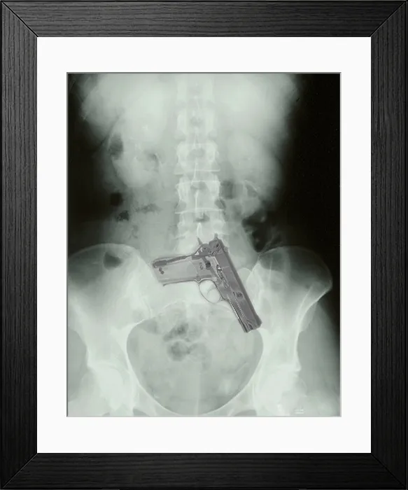 Framed Print : Chest x-ray showing hidden gun