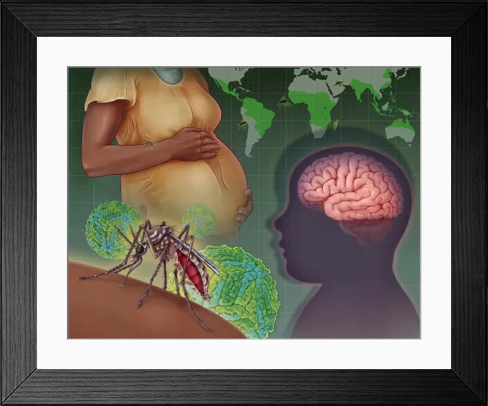 Framed Print : Zika Virus, illustration