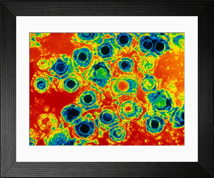 Framed Print : Herpes Simplex Virus (TEM) Framed Print : Herpes Simplex Virus (TEM)