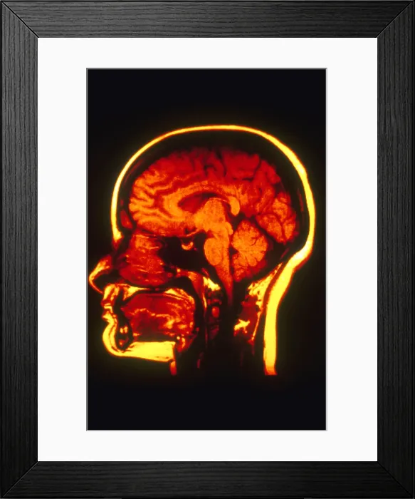 Framed Print : MRI of Head Framed Print : MRI of Head