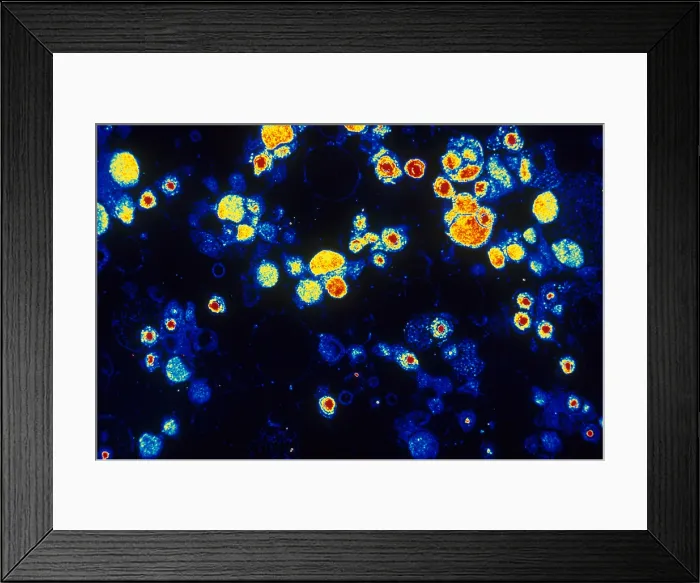 Framed Print : Cytomegalovirus (TEM)