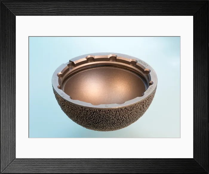 Framed Print : Artificial Hip Joint Socket