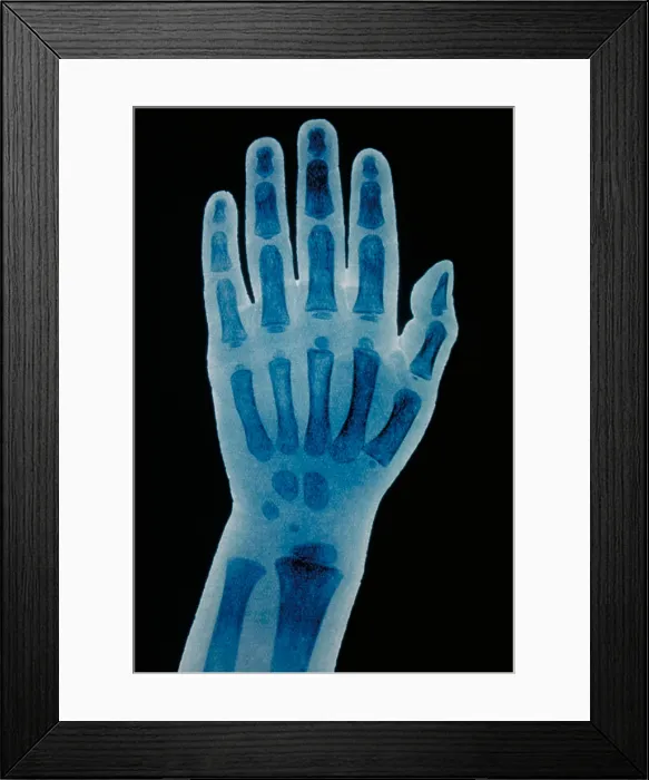 Framed Print : Hand x-ray of a 2 year old child Framed Print : Hand x-ray of a 2 year old child