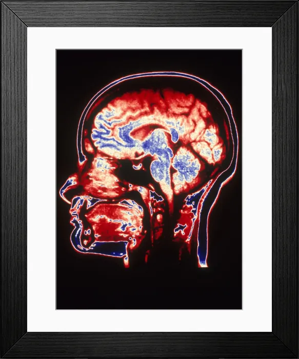 Framed Print : MRI of Head Framed Print : MRI of Head