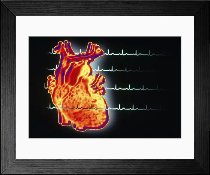 Framed Print : Healthy EKG Framed Print : Healthy EKG