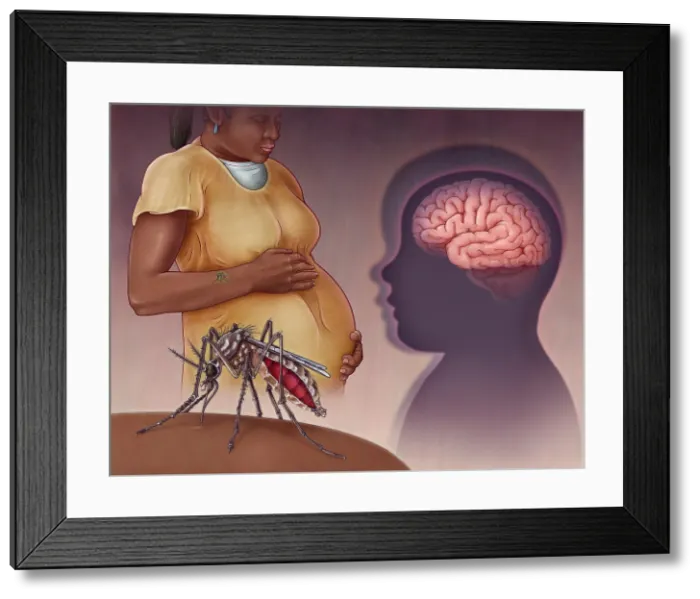 Framed Print : Zika Virus, illustration