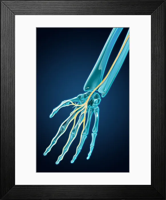 Framed Print : Median Nerve, Illustration