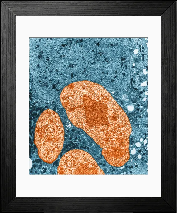 Framed Print : Nosema apis (TEM) Framed Print : Nosema apis (TEM)
