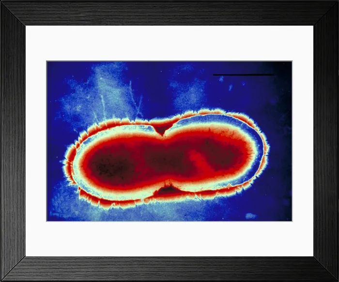 Framed Print : Pseudomonas cepacea Framed Print : Pseudomonas cepacea
