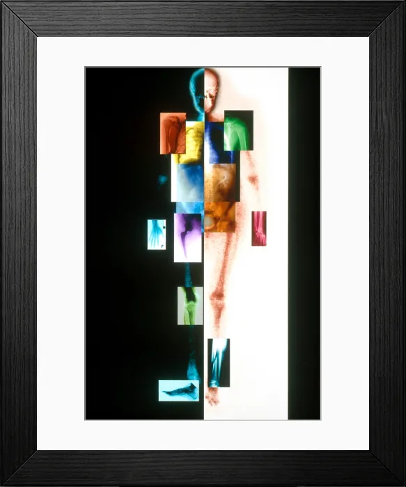 Framed Print : Medical Imaging Montage Framed Print : Medical Imaging Montage