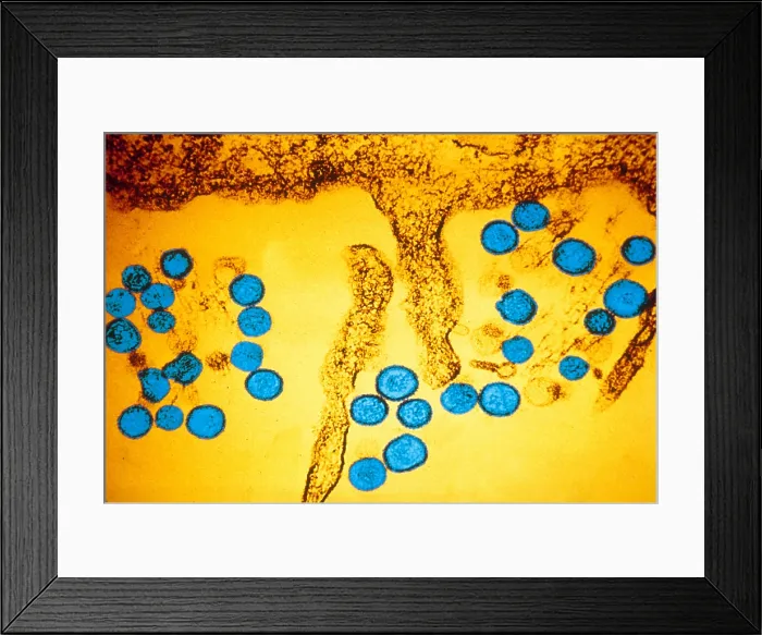 Framed Print : Hanta Virus (TEM) Framed Print : Hanta Virus (TEM)