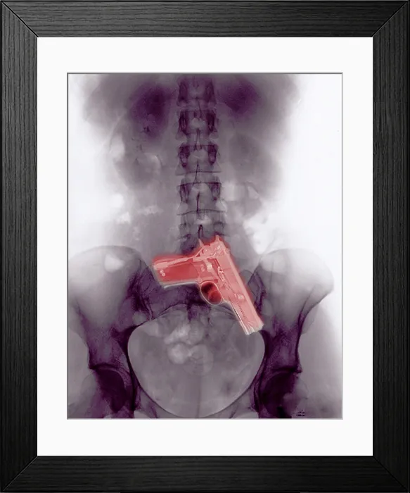Framed Print : Chest x-ray showing hidden gun